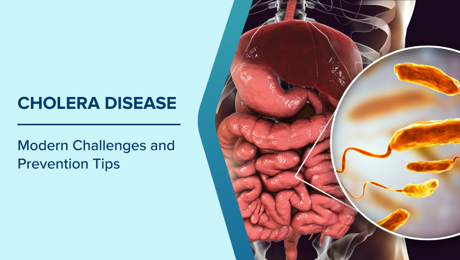 Cholera Disease