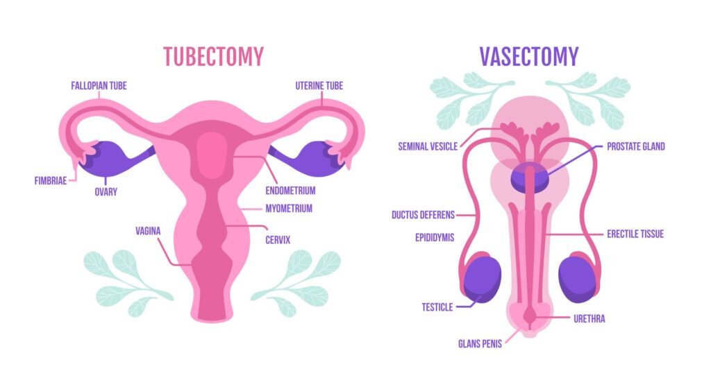 What is Vasectomy and Tubectomy