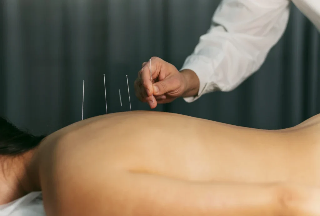 Acupuncture and Acupressure-jagannathsevasadan.com